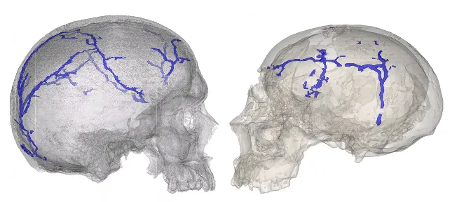 Cómo estudiar el sistema vascular interno del cráneo