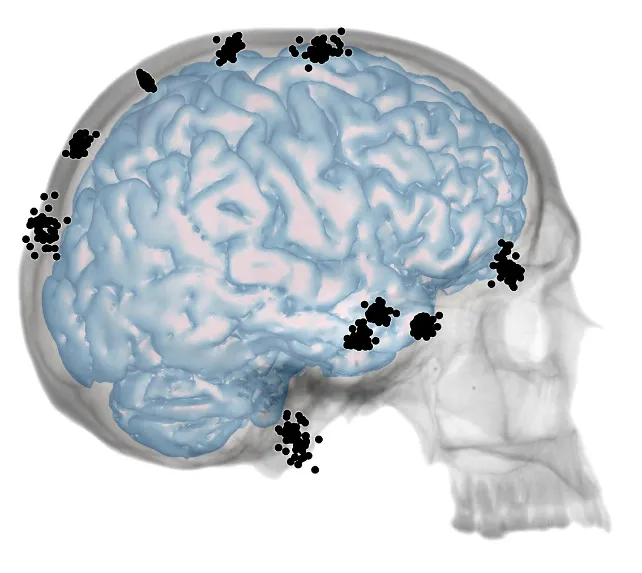 Ciencia Burgos: Nuevo estudio sobre la integración entre cráneo y cerebro