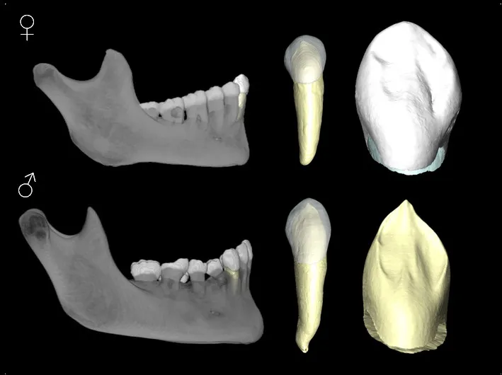 Ciencia Burgos: Nueva metodología forense permite identificar el sexo de restos humanos con una fiabilidad del 92%