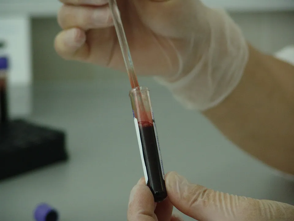 Universidad Burgos: Investigadores de la UBU participan en un proyecto científico del SIDA