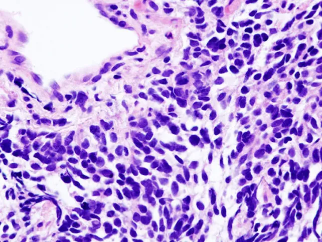 Ciencia Burgos: Un estudio vincula los metales del suelo con la mortalidad por cáncer