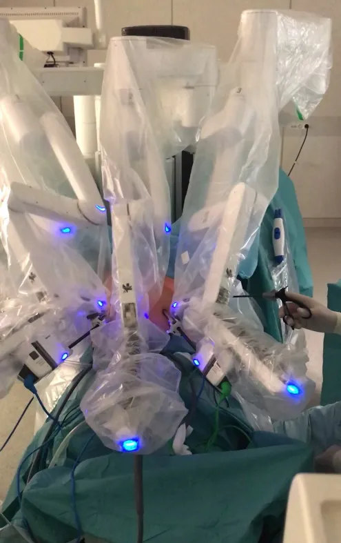 Local Burgos: El robot Da Vinci opera en Burgos por primera vez