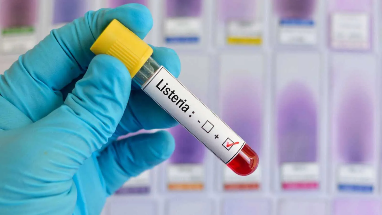 Alerta Rápida Alimentaria en Castilla y León tras encontrar carne contaminada con listeria en Segovia