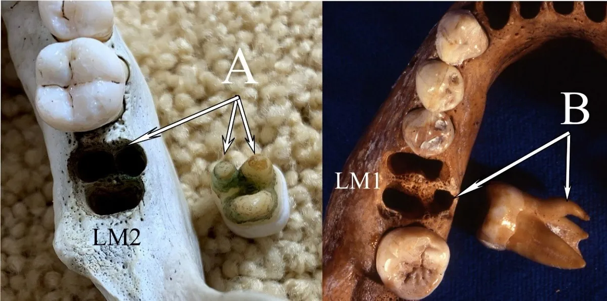 Desmienten las similitudes entre los dientes de los denisovanos y los asiáticos actuales