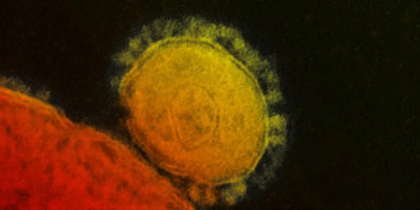 Un robot analizará en Castilla y León hasta 1.400 muestras al día en busca de coronavirus