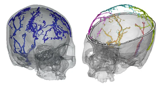 Un estudio analiza el crecimiento y desarrollo de las venas diploicas en los humanos modernos