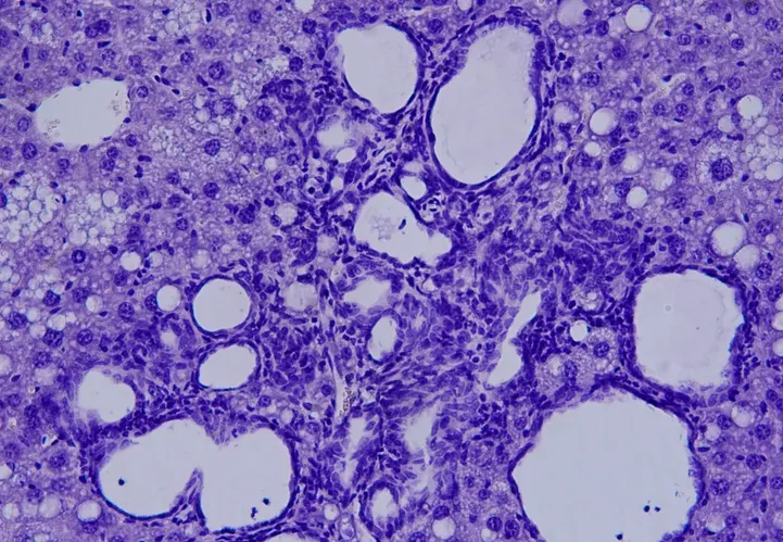 Investigadores españoles descubren un nuevo mecanismo que controla la aparición del cáncer de hígado en animales