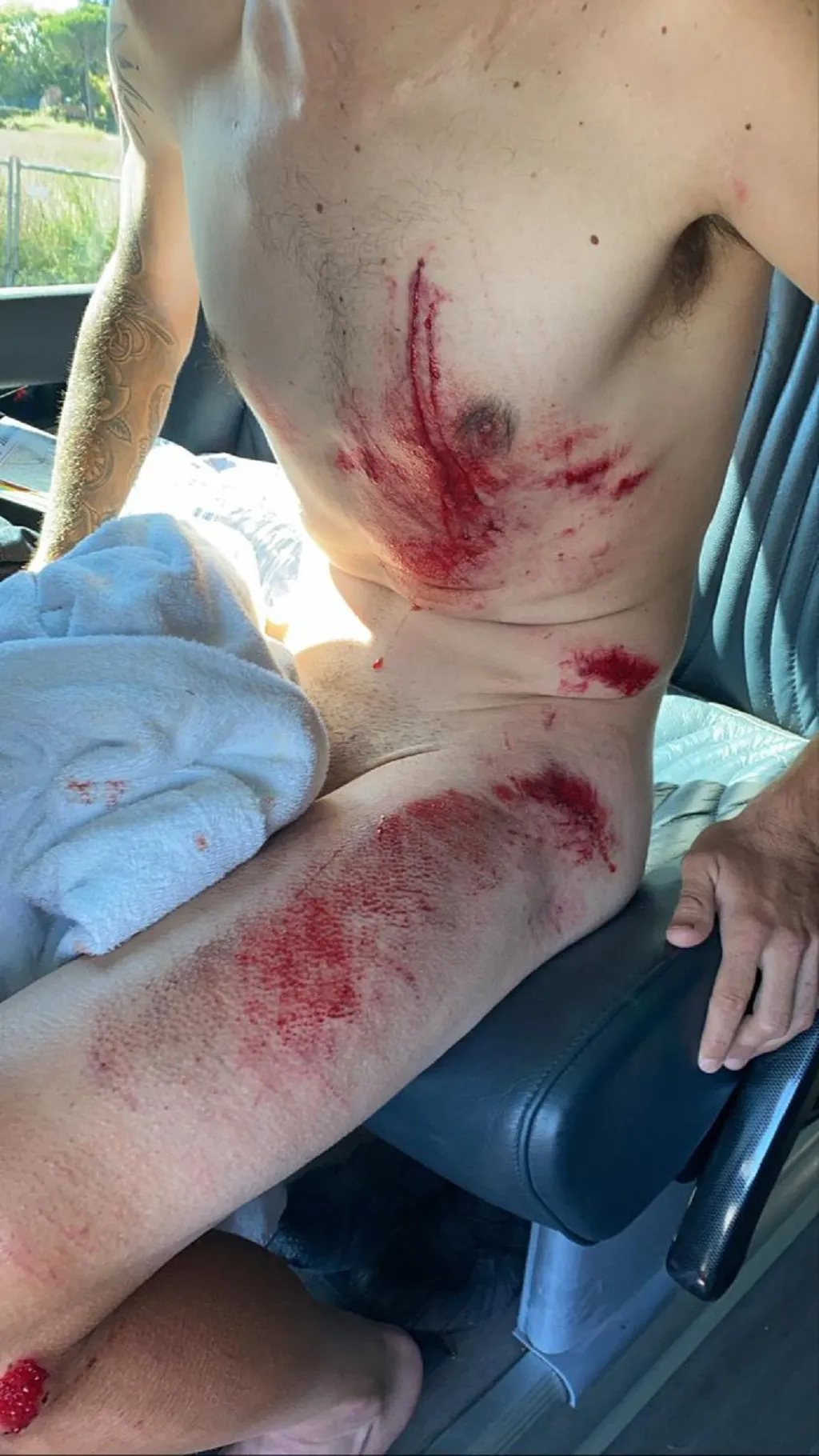 Ángel Madrazo sufre la cara más amarga y dura del ciclismo