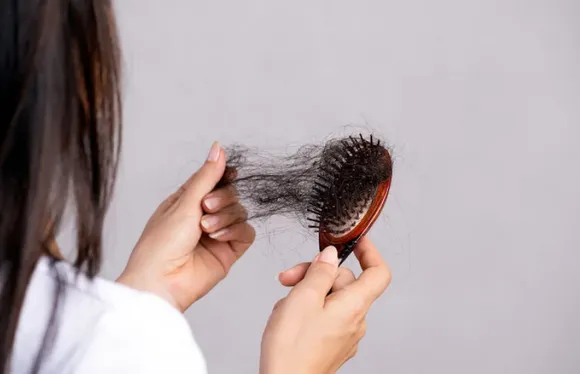 Cómo frenar la caída del cabello con remedios caseros