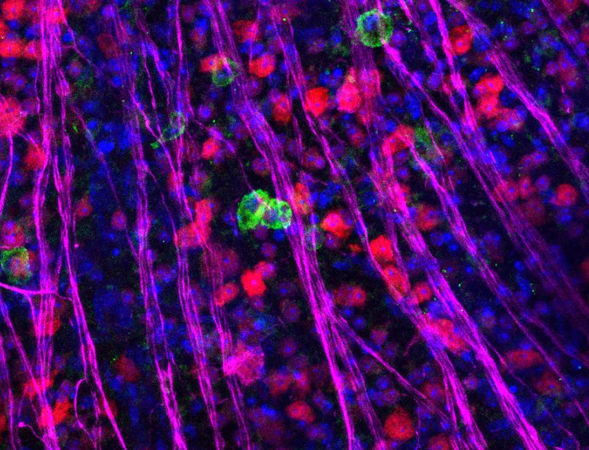 Mejoras en los trasplantes retinianos abren nuevas vías para tratar la pérdida de visión