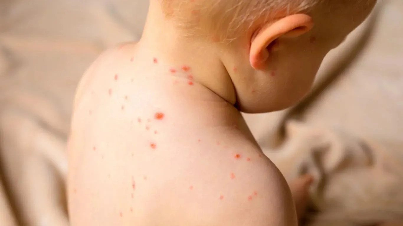 Éste es el virus más contagioso... y no es el sars-cov-2