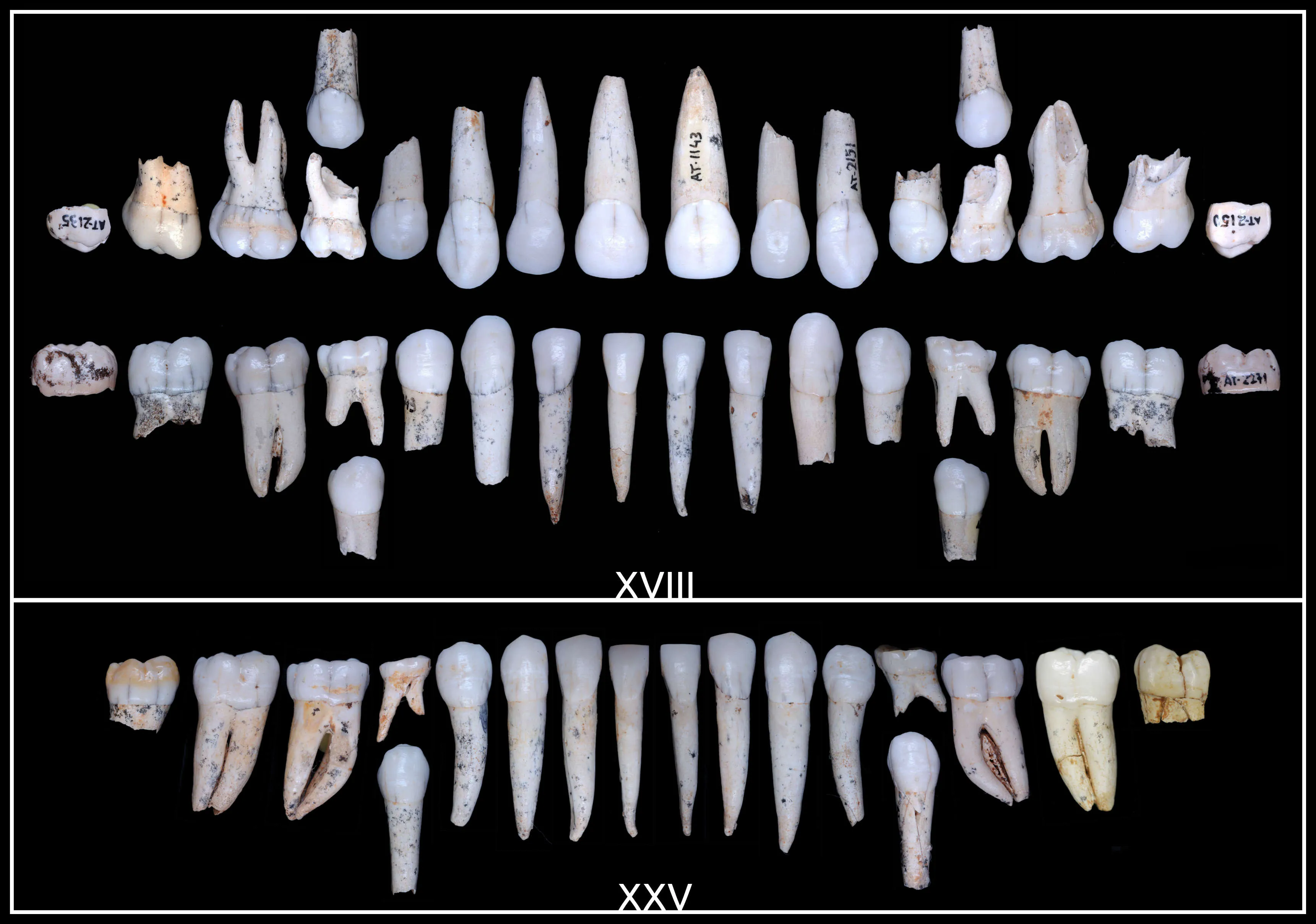 Los homininos de Atapuerca tenían un desarrollo dental más rápido que los humanos modernos