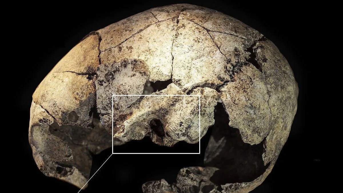 Identifican en Burgos la primera cirugía de oído exitosa de la humanidad