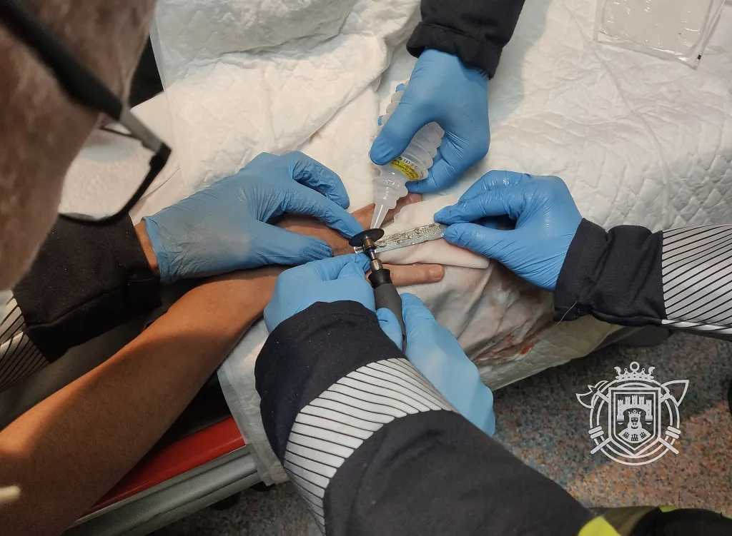 Los Bomberos acuden al HUBU para extraer un anillo que se había quedado atascado
