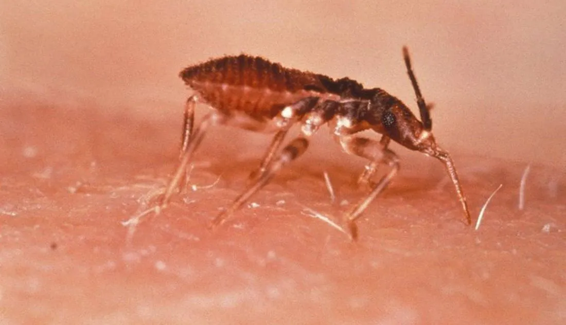 La enfermedad de Chagas está infradiagnosticada en España, según alerta un estudio