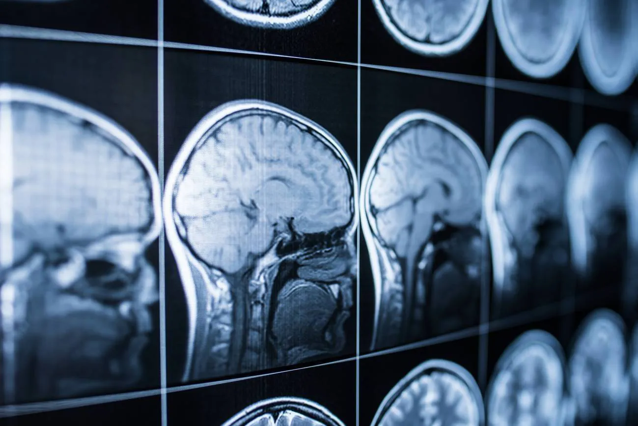 Expertos nacionales e internacionales abordarán en Burgos la parálisis cerebral desde un enfoque multidisciplinar